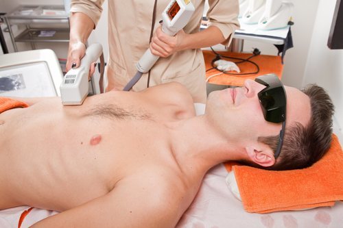 Técnicas como el láser han mejorado la comodidad de la depilación masculina.